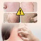 Sulfur Moisturizing Anti-Itch Body Lotion