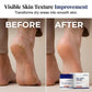 Intensive Repair Foot Cream for Cracked Heels & Calluses