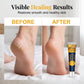 🦶 BUY 3 GE 5 FREE – Moisturizing Foot Cream for Dry & Rough Feet | Nourishes Dry Skin & Helps Keep Feet Soft and Supple | Daily Foot Care